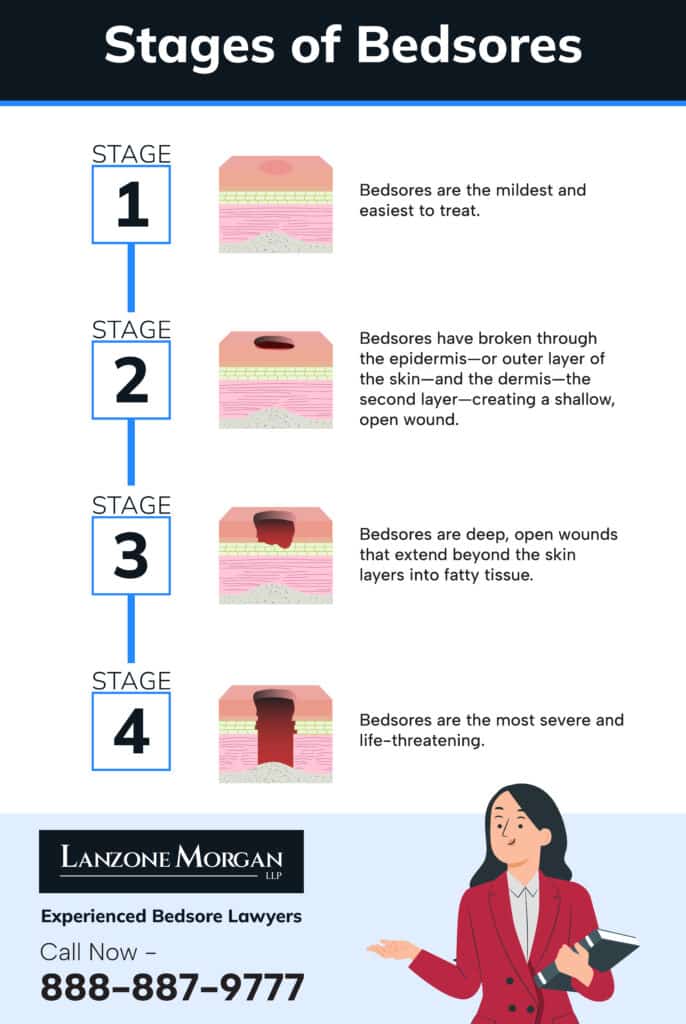the stages of bedsores in nursing homes