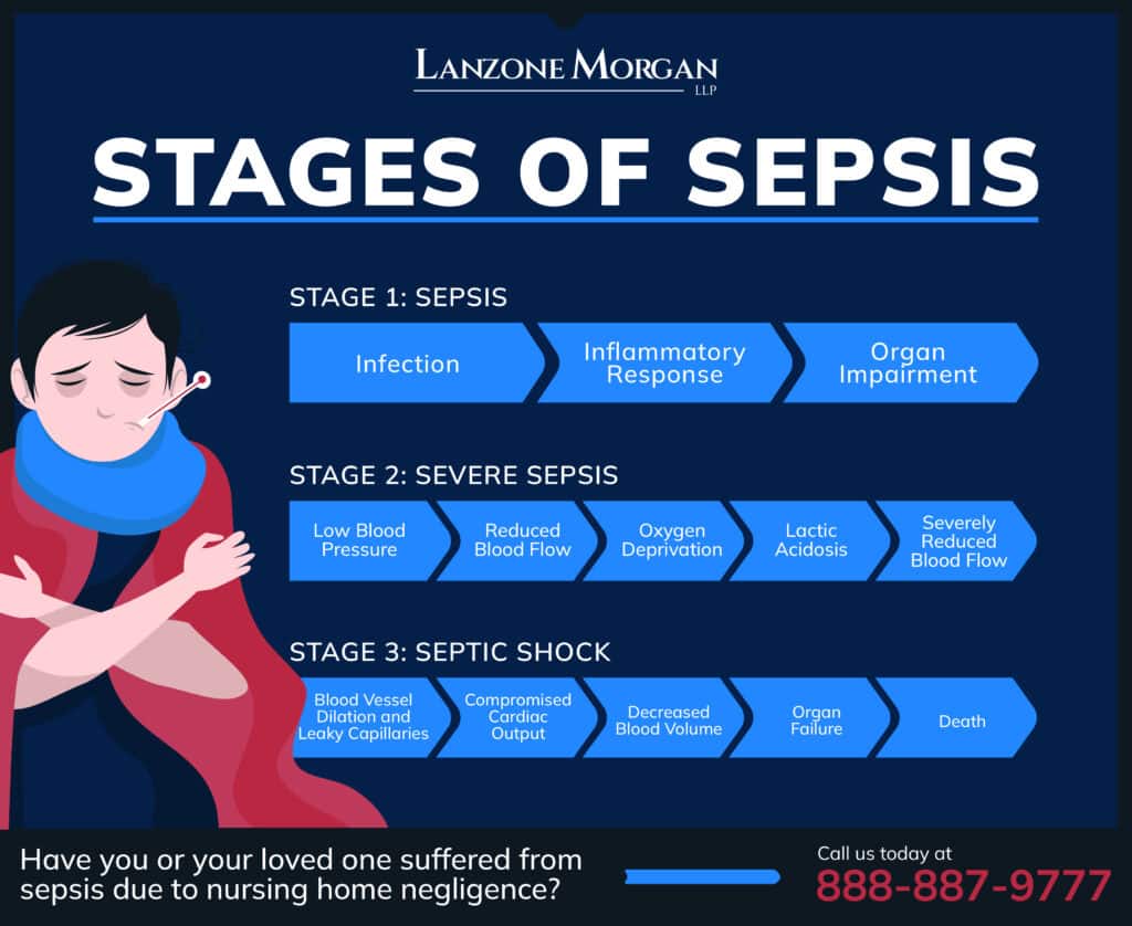Stages of sepsis infographic / stage 1, stage 2, stage 3